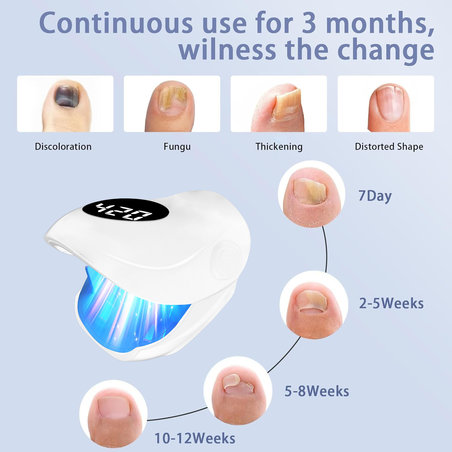 Effective Nail Fungus Removal  - Industrial Laser Removal ulasan dan harga